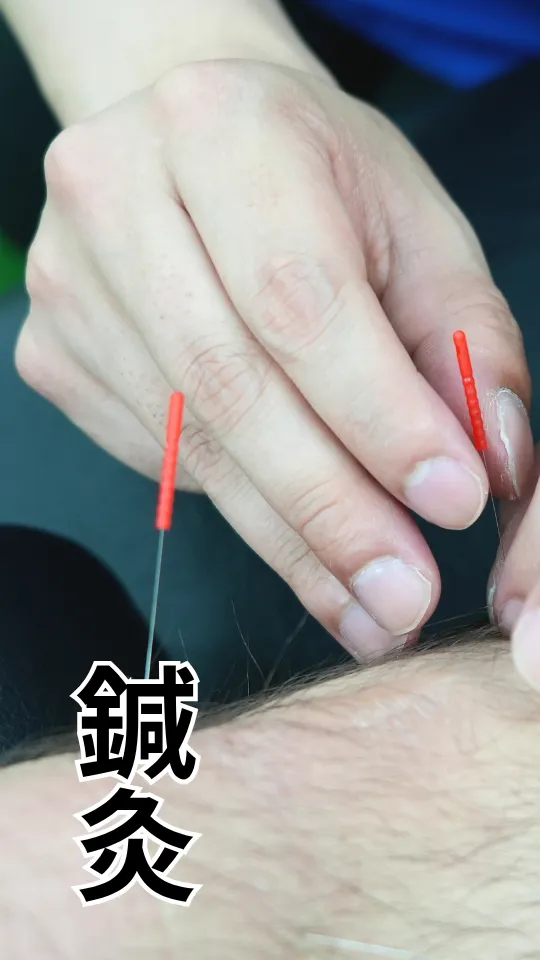 鍼灸治療